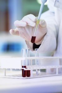 Hand with vials in a lab