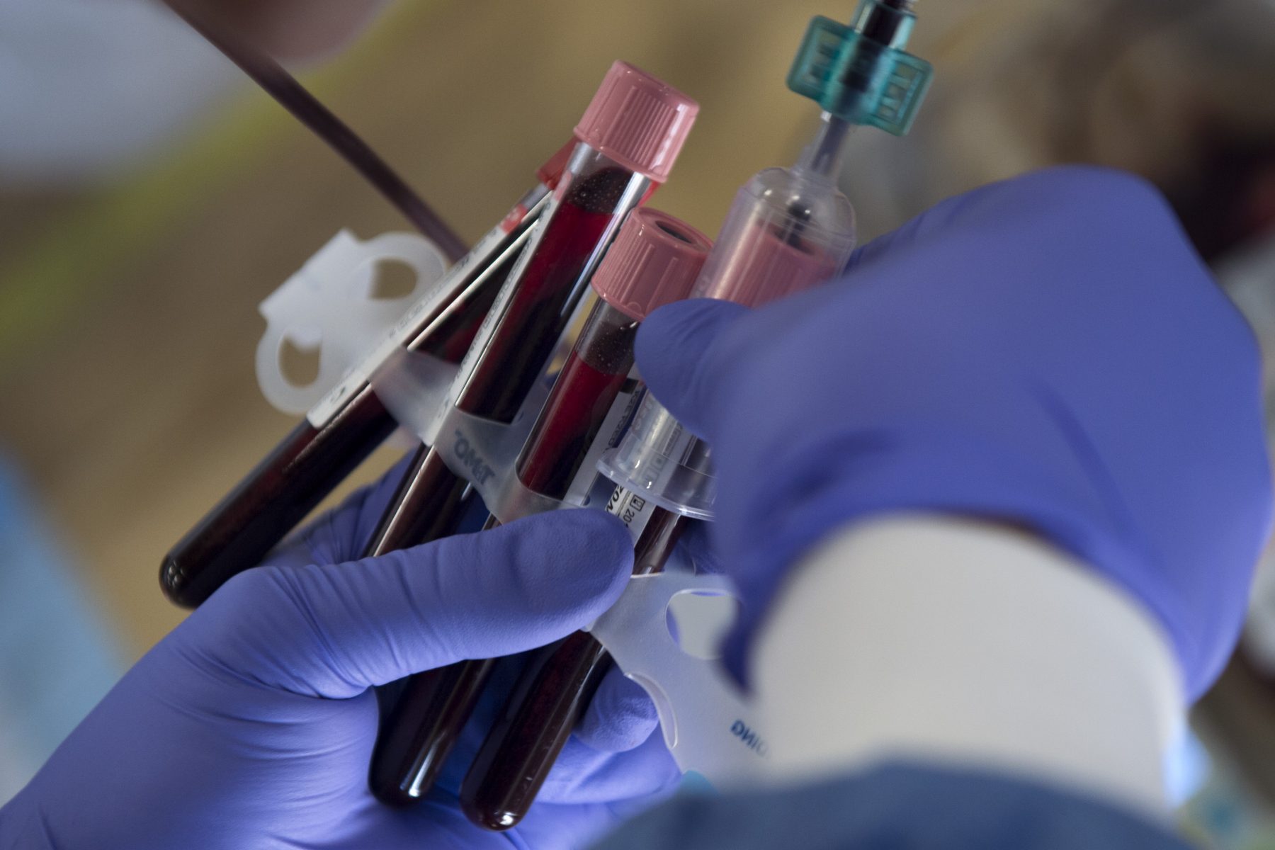 You are currently viewing Six Blood Tests You Need, But May Be Missing