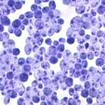 Is Candida a Real Thing? lab image of candida