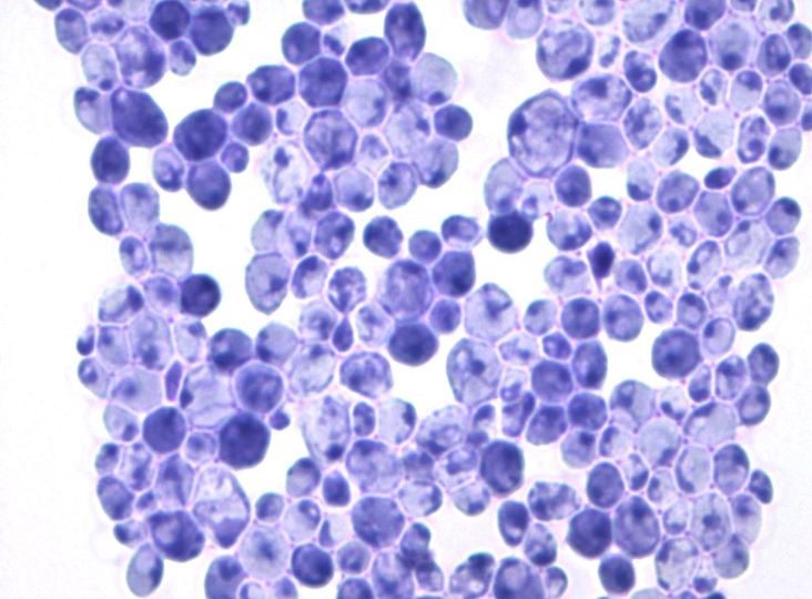 lab image of candida